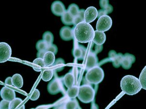 Candidoses vaginales : Causes, Diagnostic, Traitement et Prévention Candidoses vaginales : Causes, Diagnostic, Traitement et Prévention