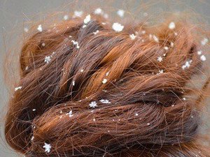 La guerre contre les pellicules: Les shampooings sans sulfate. Moins de mousse mais plus d’efficacité. La guerre contre les pellicules: Les shampooings sans sulfate. Moins de mousse mais plus d’efficacité.